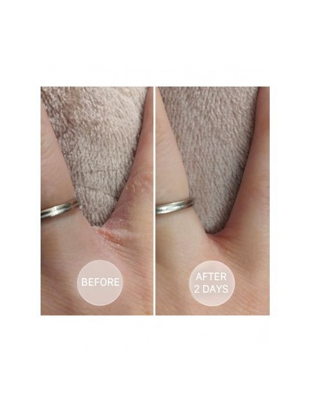 S.O.S - Intensely moisturizing ointment with Vitamine E SOS - 5 - Categories - 