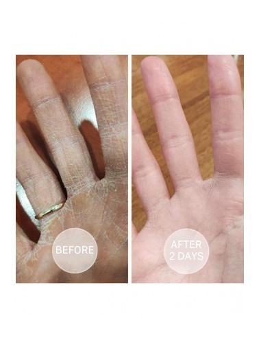 S.O.S - Intensely moisturizing ointment SOS - 4 - Categories - 