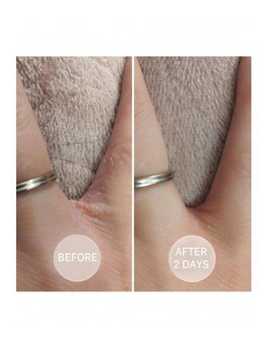 S.O.S - Intensely moisturizing ointment SOS - 5 - Categories - 